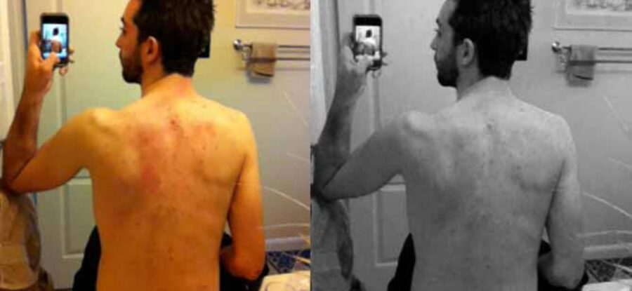 FaB – How The Gut, The Brain, and The Skin Affect Each Other: Skin in the Game