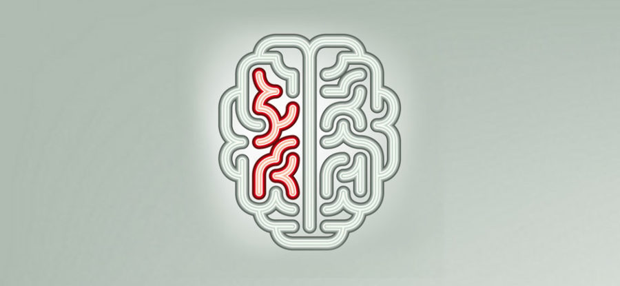 Why the Current Model of Neurorehabilitation Does Not Work as Well as It Could: The Proof is in the Pudding and the Problem is in the Paradigm