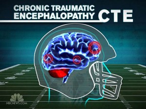 CTE in Football